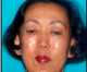 Sun Ja Choi  Missing Person from La Mirada Has Been Found